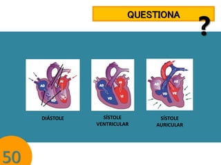 QUESTIONA

DIÁSTOLE

50

SÍSTOLE
VENTRICULAR

SÍSTOLE
AURICULAR

?

 
