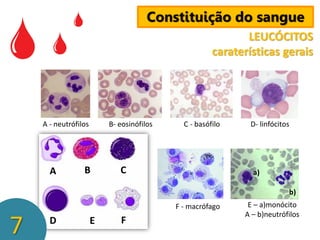 Constituição do sangue
LEUCÓCITOS
caraterísticas gerais

A - neutrófilos

A

B- eosinófilos

B

C - basófilo

C

D- linfócitos

a)
b)
F - macrófago

7

D

E

F

E – a)monócito
A – b)neutrófilos

 