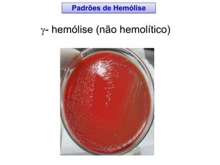 - hemólise (não hemolítico)
Padrões de Hemólise
 
