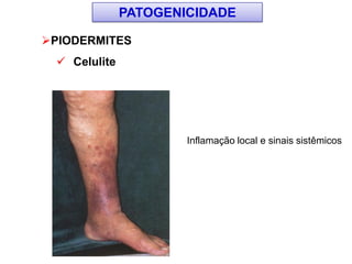 PIODERMITES
 Celulite
Inflamação local e sinais sistêmicos
PATOGENICIDADE
 