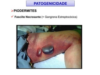 PIODERMITES
 Fasciíte Necrosante (= Gangrena Estreptocócica)
PATOGENICIDADE
 