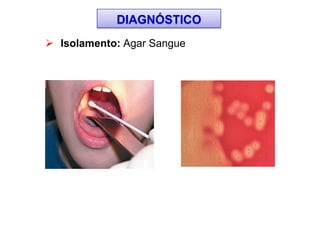  Isolamento: Agar Sangue
DIAGNÓSTICO
 