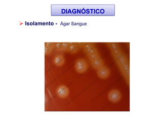  Isolamento - Ágar Sangue
DIAGNÓSTICO
 