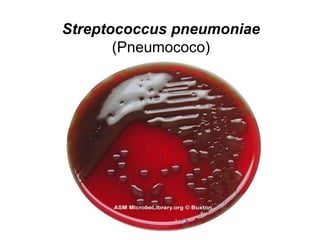 Streptococcus pneumoniae
(Pneumococo)
 