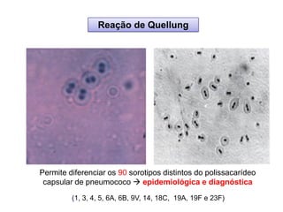 Reação de Quellung
Permite diferenciar os 90 sorotipos distintos do polissacarídeo
capsular de pneumococo  epidemiológica e diagnóstica
(1, 3, 4, 5, 6A, 6B, 9V, 14, 18C, 19A, 19F e 23F)
 
