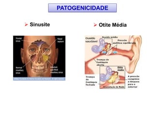  Sinusite  Otite Média
PATOGENICIDADE
 