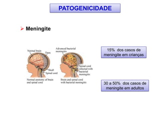  Meningite
15% dos casos de
meningite em crianças
30 a 50% dos casos de
meningite em adultos
PATOGENICIDADE
 