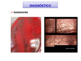  Isolamento
DIAGNÓSTICO
 