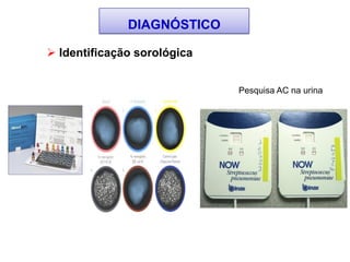 DIAGNÓSTICO
 Identificação sorológica
Pesquisa AC na urina
 