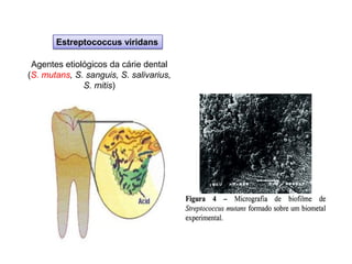 Estreptococcus viridans
Agentes etiológicos da cárie dental
(S. mutans, S. sanguis, S. salivarius,
S. mitis)
 