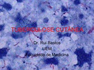 TUBERCULOSE CUTÂNEA
Dr. Rui Bastos
UEM
Faculdade de Medicina
 