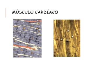 MÚSCULO CARDÍACO
 