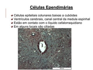 Células Ependimárias
Células epiteliais colunares baixas a cubóides
Ventrículos cerebrais, canal central da medula espinhal
Estão em contato com o líquido cefalorraquidiano
Em alguns locais são ciliadas
 