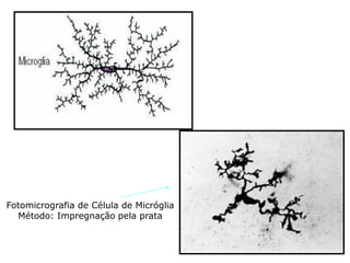 Fotomicrografia de Célula de Micróglia
Método: Impregnação pela prata
 