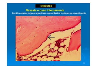 11
11
ENDÓSTEO
Reveste o osso internamente
Contém células osteoprogenitoras, osteoblastos e células de revestimento
 