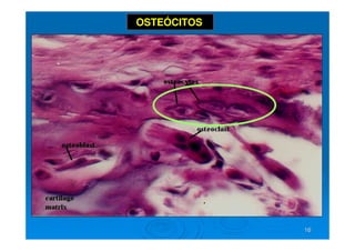 16
16
OSTEÓCITOS
 