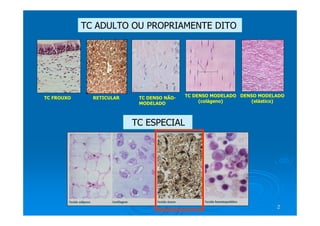 2
2
TC ADULTO OU PROPRIAMENTE DITO
TC ESPECIAL
TC FROUXO TC DENSO NÃO-
MODELADO
TC DENSO MODELADO
(colágeno)
DENSO MODELADO
(elástico)
RETICULAR
 