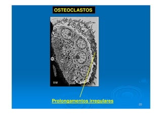 20
20
Prolongamentos irregulares
OSTEOCLASTOS
 