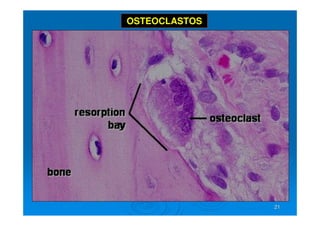 21
21
OSTEOCLASTOS
 