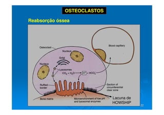 22
22
Reabsorção óssea
OSTEOCLASTOS
Lacuna de
HOWSHIP
 