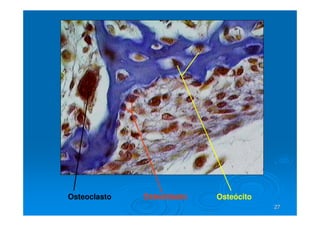 27
27
Osteoclasto Osteoblasto Osteócito
 