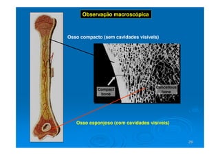 29
29
Osso compacto (sem cavidades visíveis)
Osso esponjoso (com cavidades visíveis)
Observação macroscópica
 