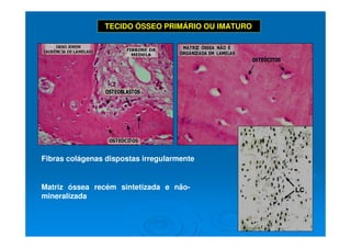 30
30
TECIDO ÓSSEO PRIMÁRIO OU IMATURO
Fibras colágenas dispostas irregularmente
Matriz óssea recém sintetizada e não-
mineralizada
 
