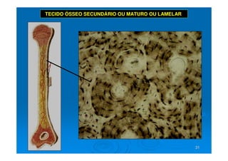 31
31
TECIDO ÓSSEO SECUNDÁRIO OU MATURO OU LAMELAR
 