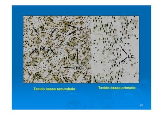 40
40
Tecido ósseo primário
Tecido ósseo secundário
 