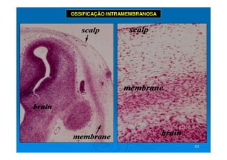43
43
OSSIFICAÇÃO INTRAMEMBRANOSA
 