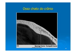 46
46
Osso chato do crânio
Osso chato do crânio
 