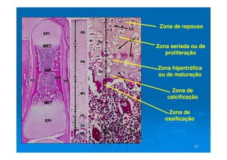 51
51
Zona de repouso
Zona seriada ou de
proliferação
Zona hipertrófica
ou de maturação
Zona de
calcificação
Zona de
ossificação
 