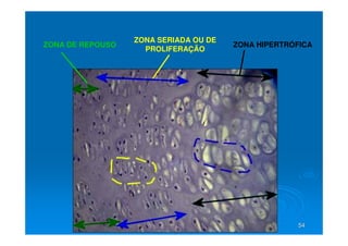 54
54
ZONA DE REPOUSO
ZONA SERIADA OU DE
PROLIFERAÇÃO
ZONA HIPERTRÓFICA
 