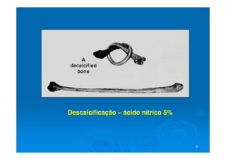 8
8
Descalcificação – ácido nítrico 5%
 