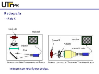 Radiografia 
1- Raio X 
Imagem com tela fluoroscópica. 
 
