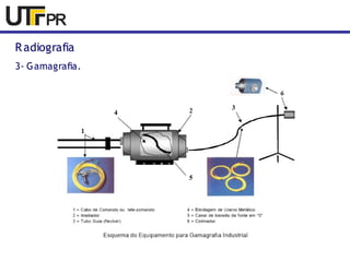 Radiografia 
3- Gamagrafia. 
 