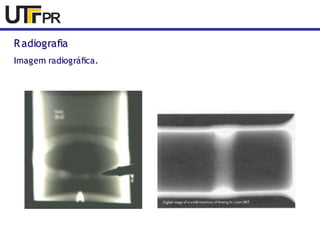 Radiografia 
Imagem radiográfica. 
 