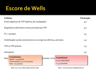 Critérios

Pontuação

Sinais objetivos de TVP (edema, dor à palpação)

3,0

Diagnóstico alternativo menos provável que TEP

3,0

FC > 100 bpm

1,5

Imobilização ≥3 dias consecutivos ou cirurgia nas últimas 4 semanas

1,5

TVP ou TEP prévias

1,5

Hemoptise

1,0

Probabilidade:
•baixa < 2,0 pontos
•intermediária 2,0 aa 6,0 pontos
•intermediária 2,0 6,0 pontos
•alta >> 6,0 pontos
•alta 6,0 pontos

Probabilidade:
Probabilidade:
Probabilidade:
Neoplasia maligna (ativa ou término do tratamento < 6 meses)
•baixa < 2,0 pontos

Wells. Ann Intern Med 1998;129:997-1005.

•≤≤ 4,0 improvável
• 4,0 improvável
•>> 4,0 provável
• 4,0 provável

1,0

Wells. Tromb Haemost 2000;83:416-29.

 