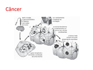 Câncer
 
