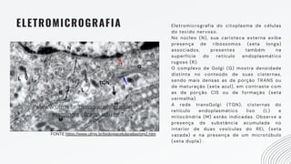ELETROMICROGRAFIA Eletromicrografia do citoplasma de células
do tecido nervoso.
No núcleo (N), sua carioteca externa exibe
presença de ribossomos (seta longa)
associados, presentes também na
superfície do retículo endoplasmático
rugoso (R).
O complexo de Golgi (G) mostra densidade
distinta no conteúdo de suas cisternas,
sendo mais densas as da porção TRANS ou
de maturação (seta azul), em contraste com
as da porção CIS ou de formação (seta
vermelha).
A rede transGolgi (TGN), cisternas do
retículo endoplasmático liso (L) e
mitocôndria (M) estão indicadas. Observe a
presença de substância acumulada no
interior de duas vesículas do REL (seta
vazada) e na presença de um microtúbulo
(seta dupla) .
FONTE:https://www.ufrgs.br/biologiacelularatlas/org2.htm
 