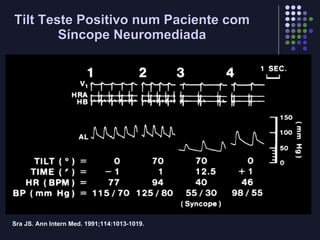 Tilt Teste Positivo num Paciente com Síncope Neuromediada Sra JS. Ann Intern Med. 1991;114:1013-1019. 