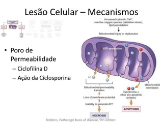 Lesão Celular – Mecanismos
• Poro de
Permeabilidade
– Ciclofilina D
– Ação da Ciclosporina
Robbins, Pathologic basis of disease, 9th edition
 