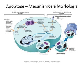 Apoptose – Mecanismos e Morfologia
Robbins, Pathologic basis of disease, 9th edition
 