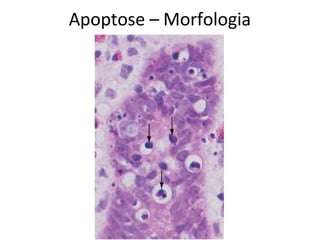 Apoptose – Morfologia
 