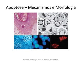 Apoptose – Mecanismos e Morfologia
Robbins, Pathologic basis of disease, 8th edition
 