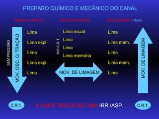 PREPARO QUÍMICO E MECÂNICO DO CANAL CÉRVICO-APICAL BATENTE APICAL ESCALONADO   –1mm SEM PRESSÃO MOV. OSC. C/ TRAÇÃO Lima L...