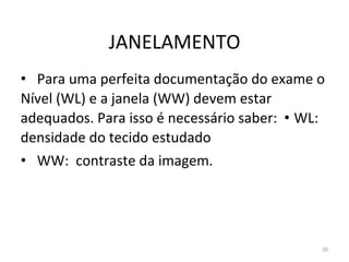 20
JANELAMENTO
• Para uma perfeita documentação do exame o
Nível (WL) e a janela (WW) devem estar
adequados. Para isso é necessário saber: • WL:
densidade do tecido estudado
• WW: contraste da imagem.
 