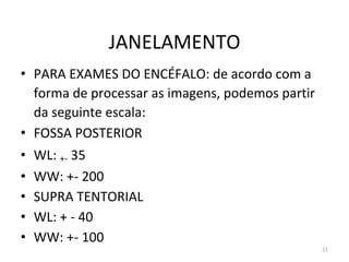 21
JANELAMENTO
• PARA EXAMES DO ENCÉFALO: de acordo com a
forma de processar as imagens, podemos partir
da seguinte escala:
• FOSSA POSTERIOR
• WL: +- 35
• WW: +- 200
• SUPRA TENTORIAL
• WL: + - 40
• WW: +- 100
 
