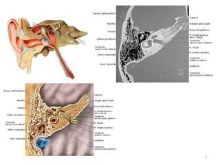 7
REVISÃO ANATÔMICA
Ainda na região da cabeça, outra
estrutura estudada em imagem é
o ouvido. O principal diagnóstico
nesta região é a Otite crônica.
 