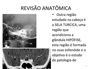 REVISÃO ANATÔMICA
8
• Outra região
estudada na cabeça é
a SELA TURCICA, uma
região que
acondiciona a
glândula HIPÓFISE,
esta região é formada
no osso esfenóide e o
objetivo é o estudo
de patologia de
 